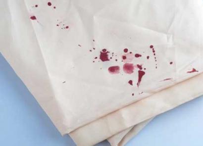 Как отстирать засохшую кровь — эффективные способы избавиться от пятен крови